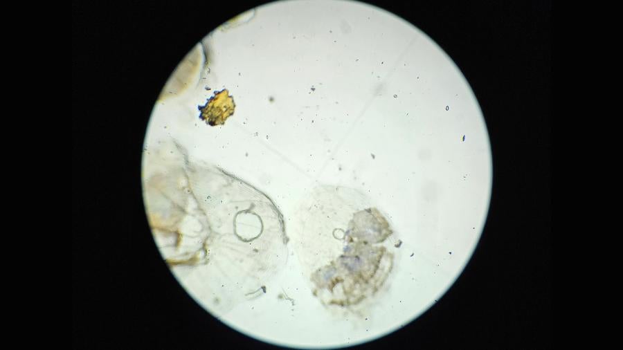 A microscopic view of a fish scale.