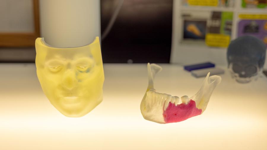 Davis prints 3D models, in exacting detail, of veterans’ body parts based on CT scans and MRIs to help their doctors with diagnosis and treatment.